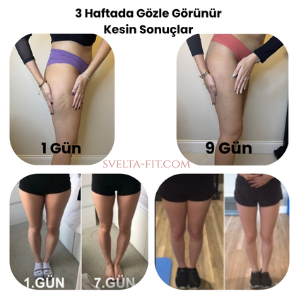 Svelta-Fit™Bacak incelten Masaj Aleti